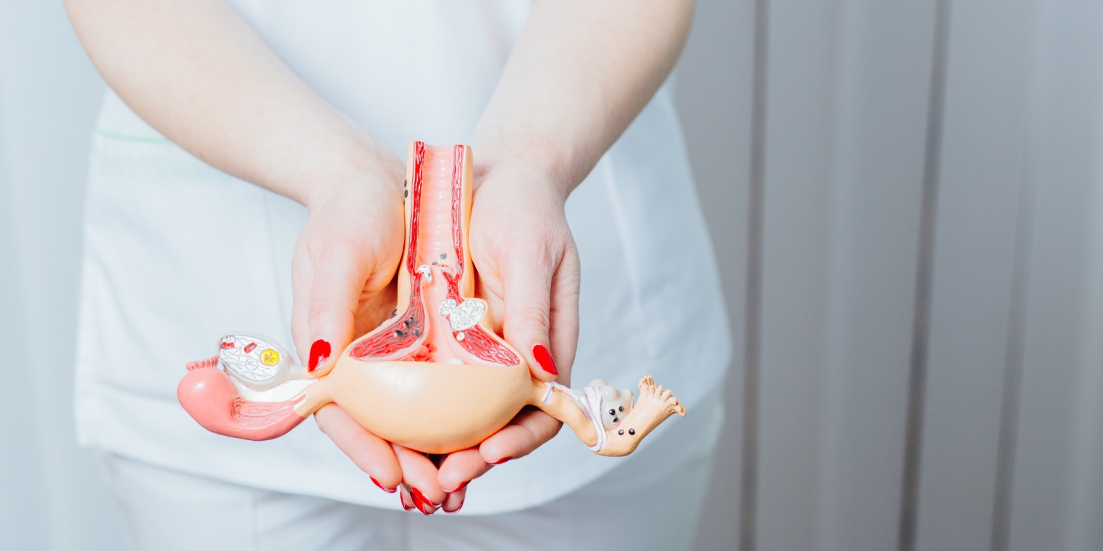 A gynecologist holding anatomical model of uterus showing causes of Endometriosis.