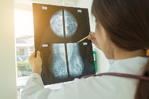 a female doctor looking at the Mammogram film image.A mammogram is an x-ray of the breast.