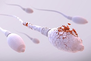 Damaged sperm cells. Barrier methods of contraception are not as effective in preventing pregnancy