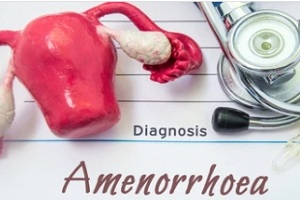amenorrhoea diagnosis concept