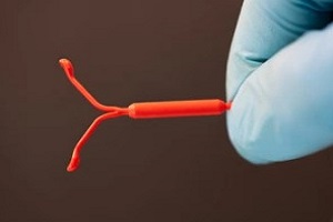 doctor holding iud device in hand for a IUD Insertion Process