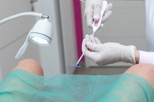 doctor placing iud insertion device in women vagina