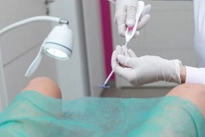 intra uterine device procedure