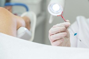 A doctor preparing an IUD for insertion