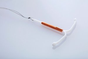 A copper IUD