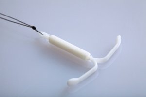 A hormonal IUD