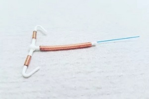 copper iud device