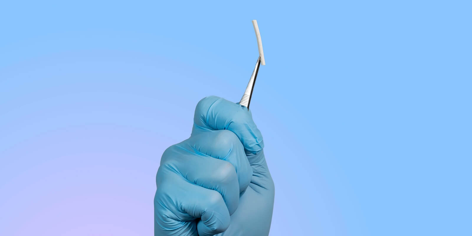 NC Gynocologist a hormonal implant with tweezers