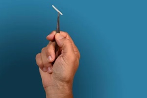 hand holding a hormonal implant with tweezers