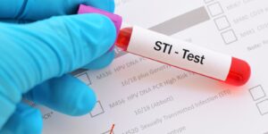 blood sample with requisition form for sexually transmitted infection test in Raleigh, NC