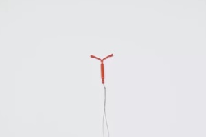 IUD device in Raleigh, NC Gynecologist Office 