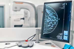 mammogram snapshot of breasts of a female patient on the monitor with undergoing mammography test on the background