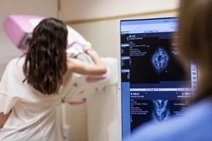 women scaning breat during mammogram