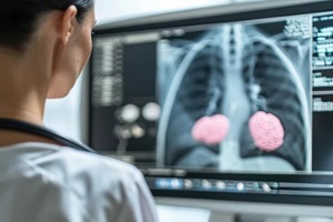 malignant tumor that forms in breast cells, often detectable by lumps, changes in shape, or other noticeable abnormalities