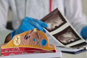 mammologist examines result of mammographic examination of breast using x-ray scan concept