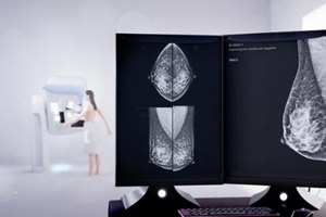 mammography device for screening breast cancer 3D woman model