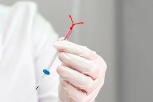 gynecologist holding an IUD birth control device