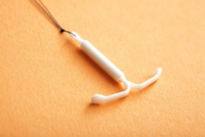 hormonal IUD